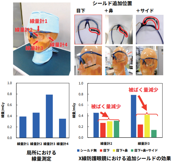 小型線量計の活用例（局所における線量測定・X線防護眼鏡における追加シールドの効果）