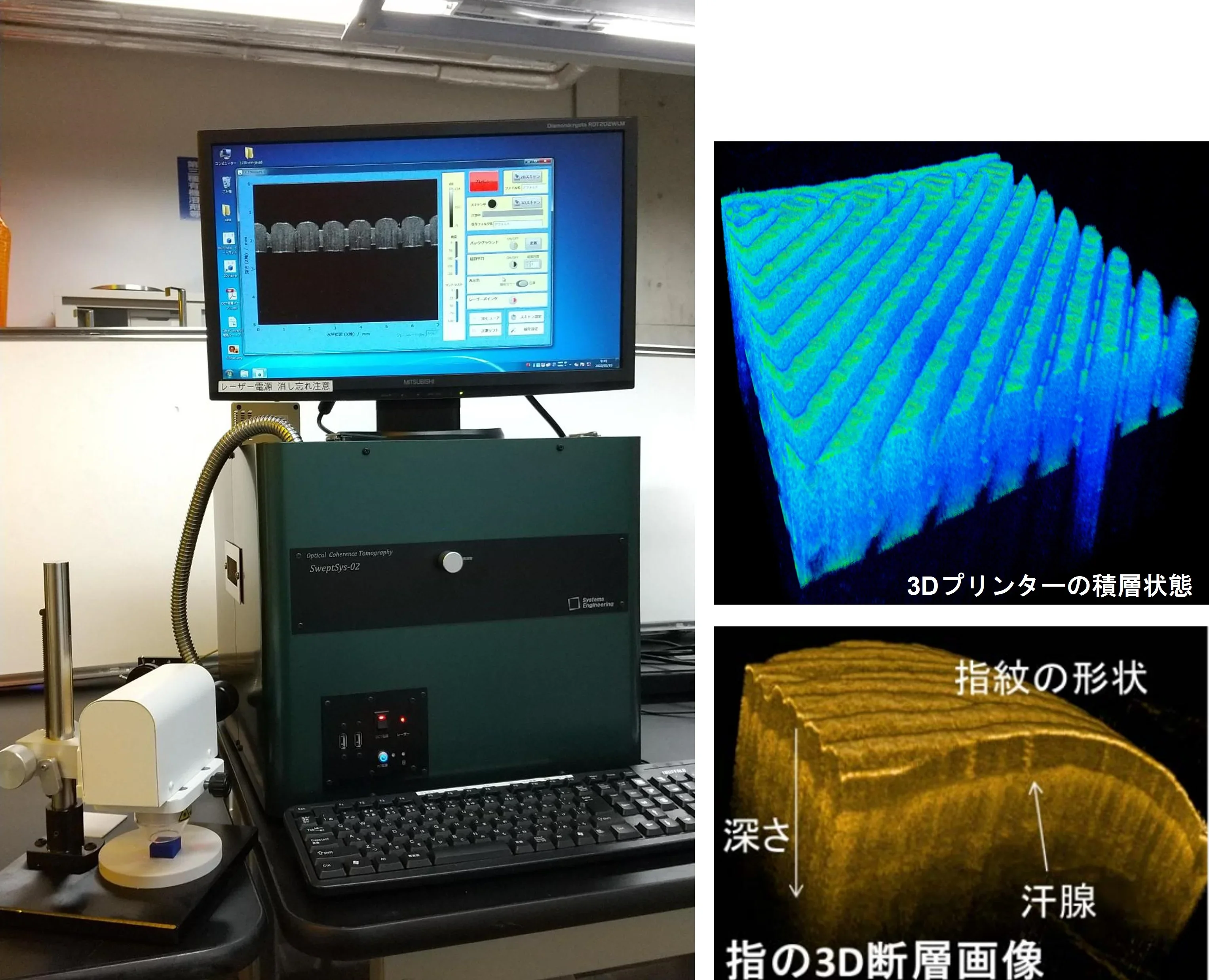 光断層画像撮影システムの画像