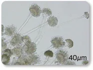 形態的特徴から菌種を特定する写真